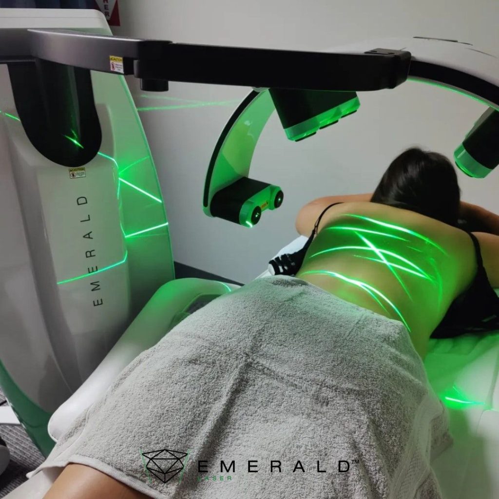 Emerald Laser for Fat Loss available in Coleraine